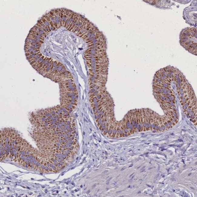 WDFY3 Antibody in Immunohistochemistry (IHC)