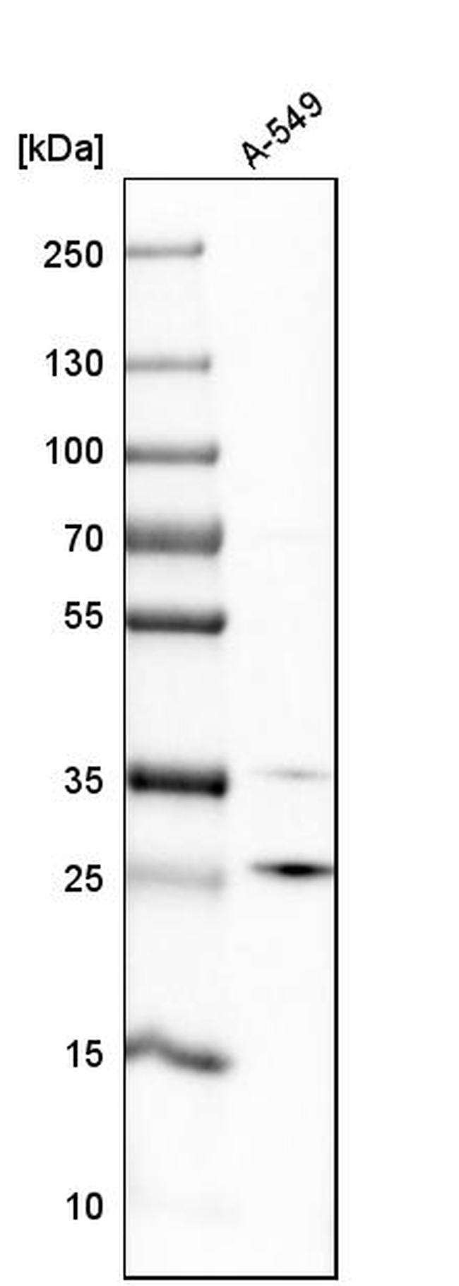 POP4 Antibody in Western Blot (WB)