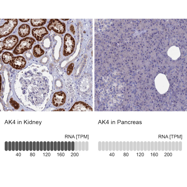 Adenylate Kinase 4 Antibody in Immunohistochemistry (IHC)