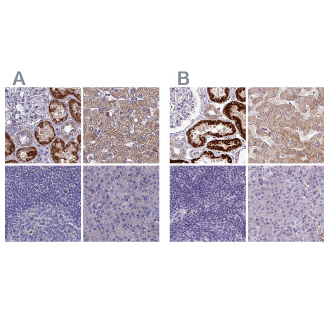 Adenylate Kinase 4 Antibody in Immunohistochemistry (IHC)