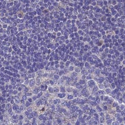 Adenylate Kinase 4 Antibody in Immunohistochemistry (IHC)