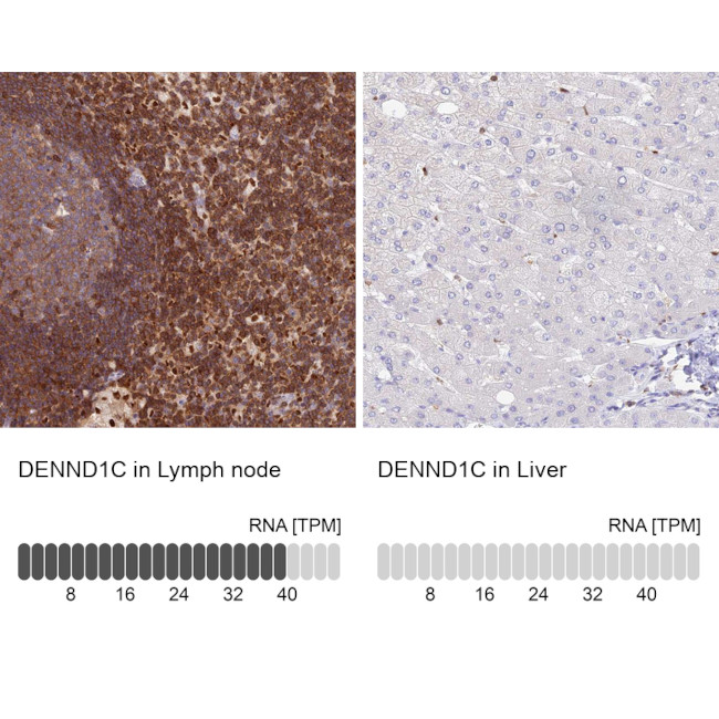 DENND1C Antibody in Immunohistochemistry (IHC)