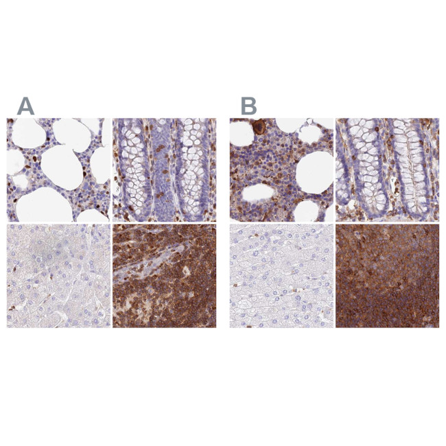 DENND1C Antibody in Immunohistochemistry (IHC)