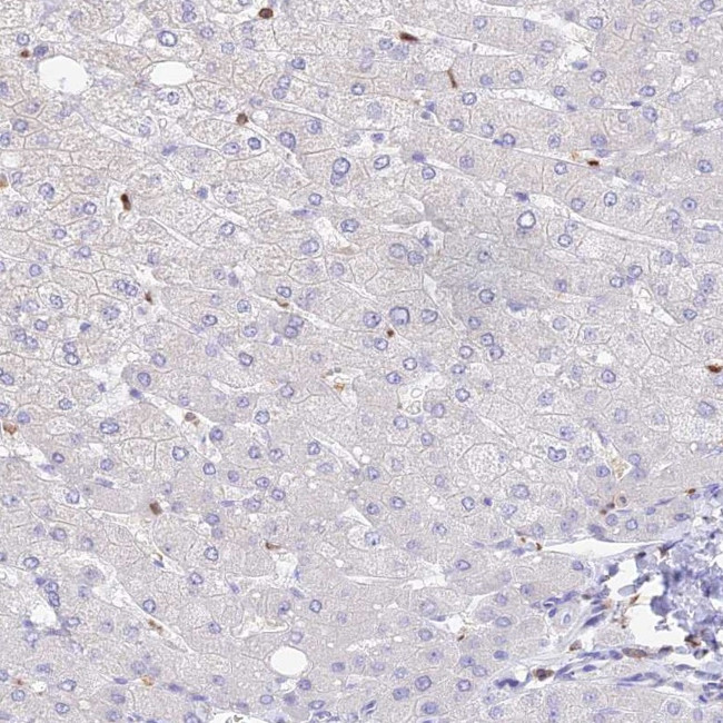 DENND1C Antibody in Immunohistochemistry (IHC)