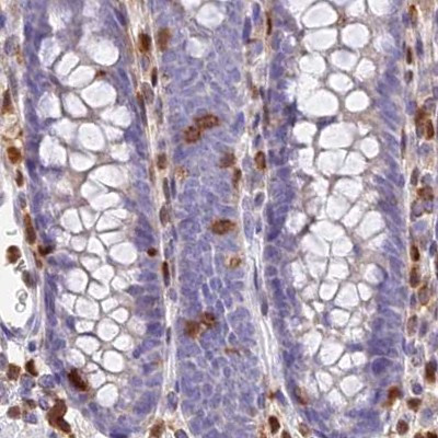 DENND1C Antibody in Immunohistochemistry (IHC)