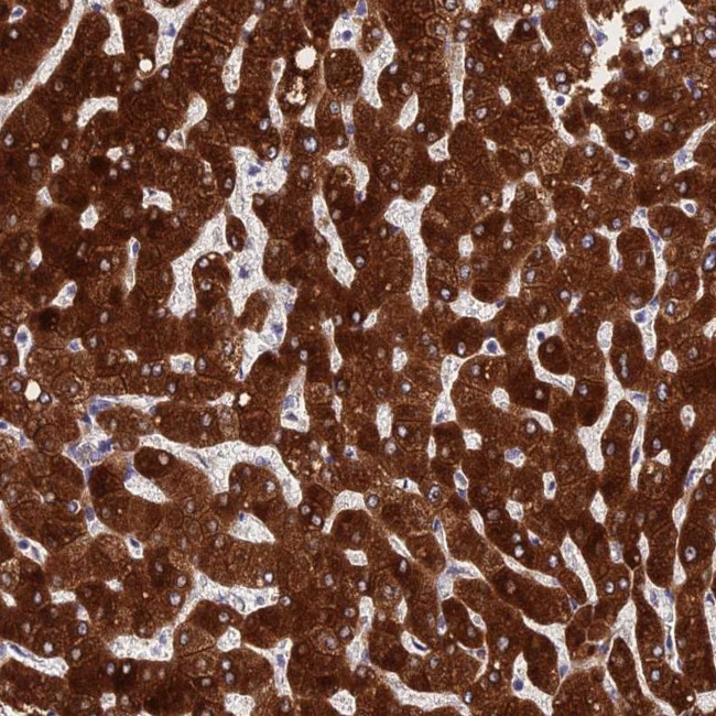 PPP2R2D Antibody in Immunohistochemistry (IHC)