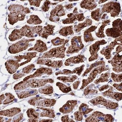 ATP5H Antibody in Immunohistochemistry (IHC)