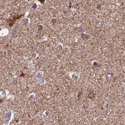 ATP5H Antibody in Immunohistochemistry (IHC)