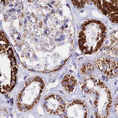 ATP5H Antibody in Immunohistochemistry (IHC)