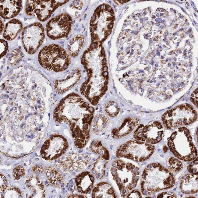 ATP5H Antibody in Immunohistochemistry (IHC)