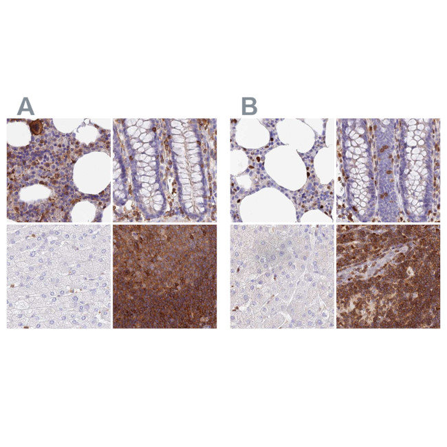 DENND1C Antibody in Immunohistochemistry (IHC)