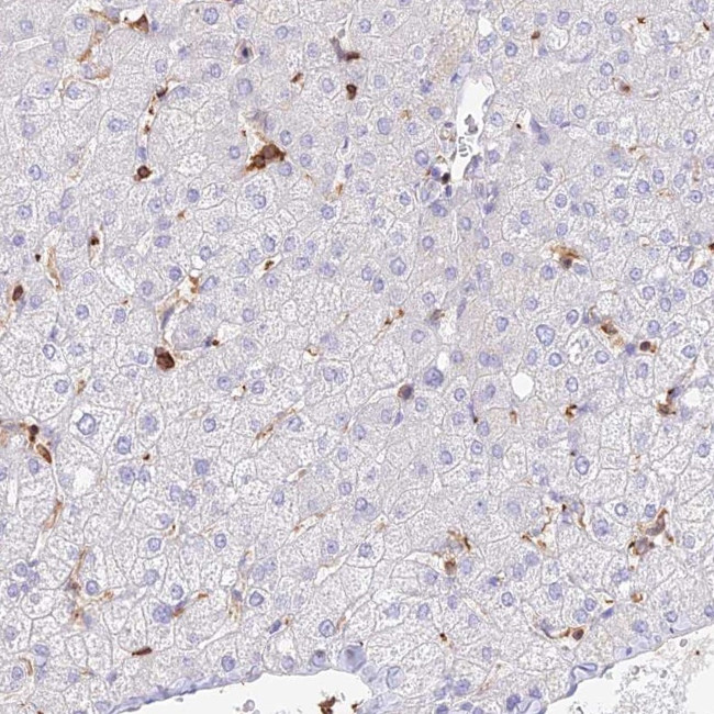 DENND1C Antibody in Immunohistochemistry (IHC)