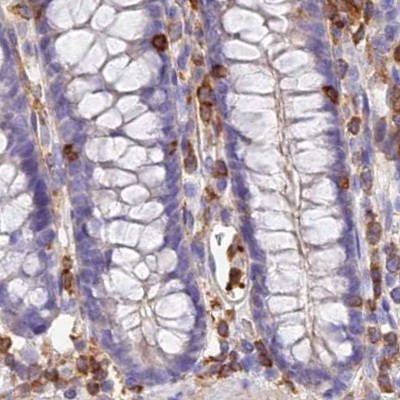 DENND1C Antibody in Immunohistochemistry (IHC)