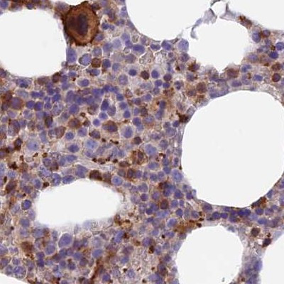 DENND1C Antibody in Immunohistochemistry (IHC)