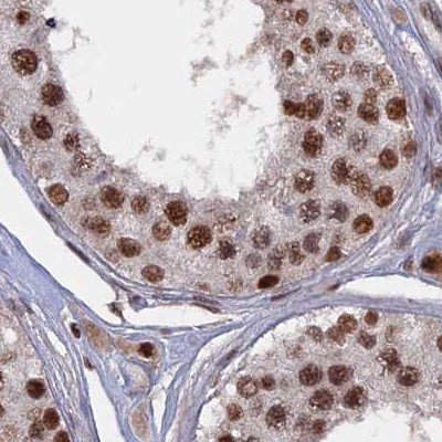 SF3A2 Antibody in Immunohistochemistry (IHC)