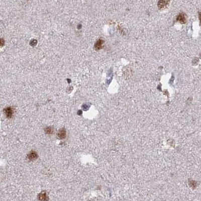 SF3A2 Antibody in Immunohistochemistry (IHC)