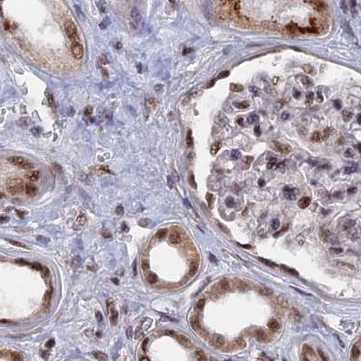 SF3A2 Antibody in Immunohistochemistry (IHC)