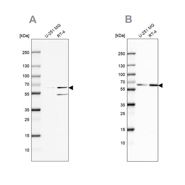 SF3A2 Antibody in Western Blot (WB)