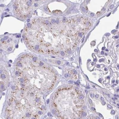 CHMP5 Antibody in Immunohistochemistry (IHC)