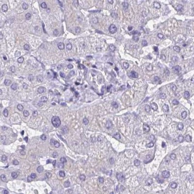 CHMP5 Antibody in Immunohistochemistry (IHC)