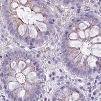 CHMP5 Antibody in Immunohistochemistry (IHC)