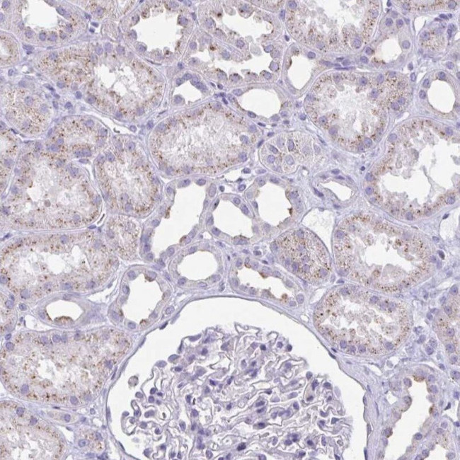 CHMP5 Antibody in Immunohistochemistry (IHC)