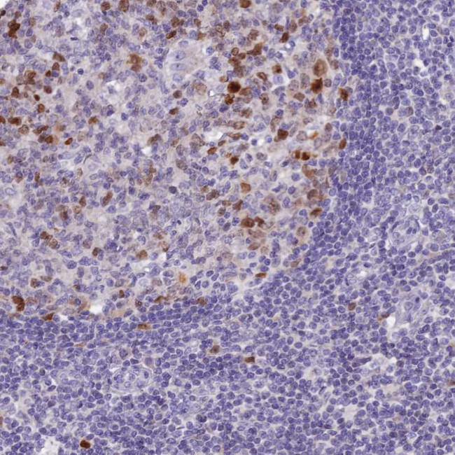 NUSAP1 Antibody in Immunohistochemistry (IHC)