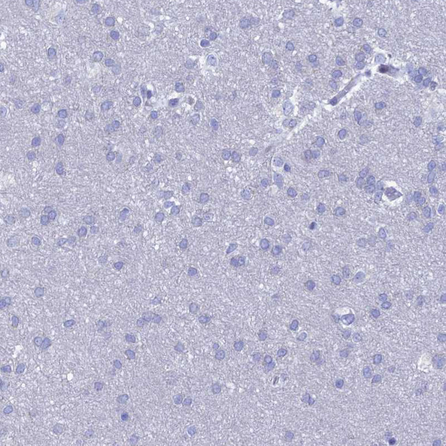 NUSAP1 Antibody in Immunohistochemistry (IHC)