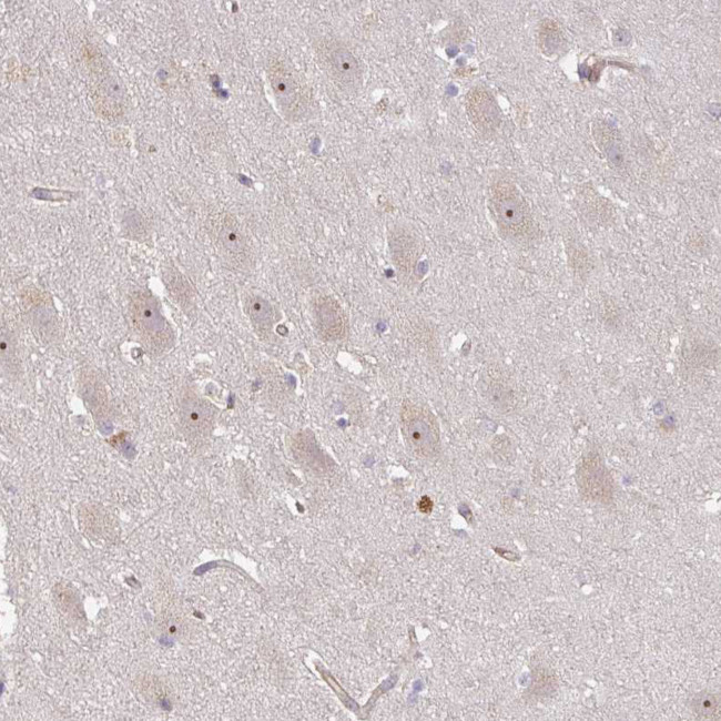 DIMT1 Antibody in Immunohistochemistry (IHC)