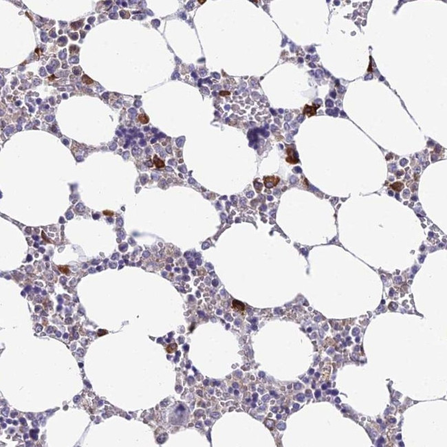 NALP12 Antibody in Immunohistochemistry (IHC)