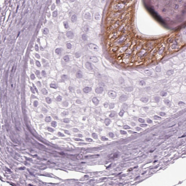 KRTAP3-3 Antibody in Immunohistochemistry (IHC)