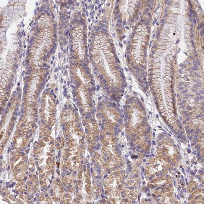 WDR5B Antibody in Immunohistochemistry (IHC)