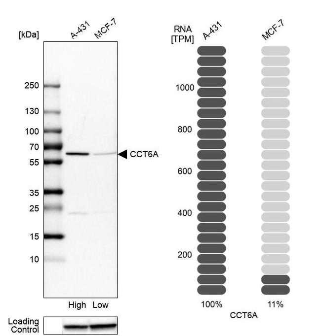 TCP-1 zeta Antibody in Western Blot (WB)