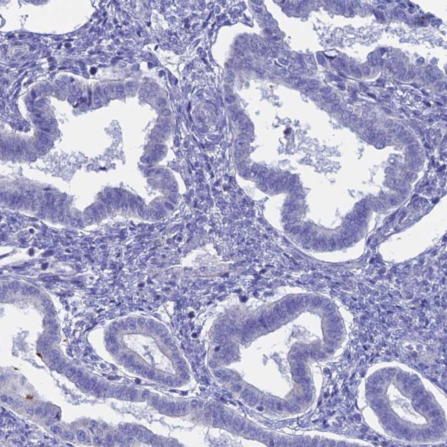 GLB1L Antibody in Immunohistochemistry (IHC)