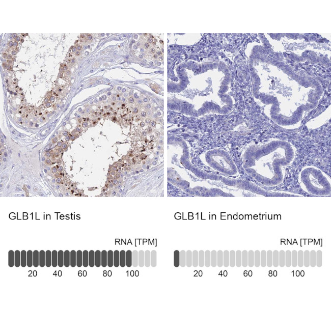 GLB1L Antibody