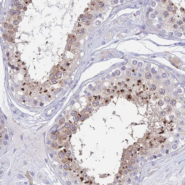 GLB1L Antibody in Immunohistochemistry (IHC)