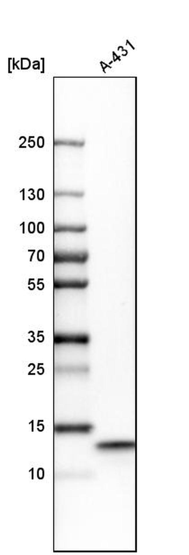 UQCRB Antibody in Western Blot (WB)