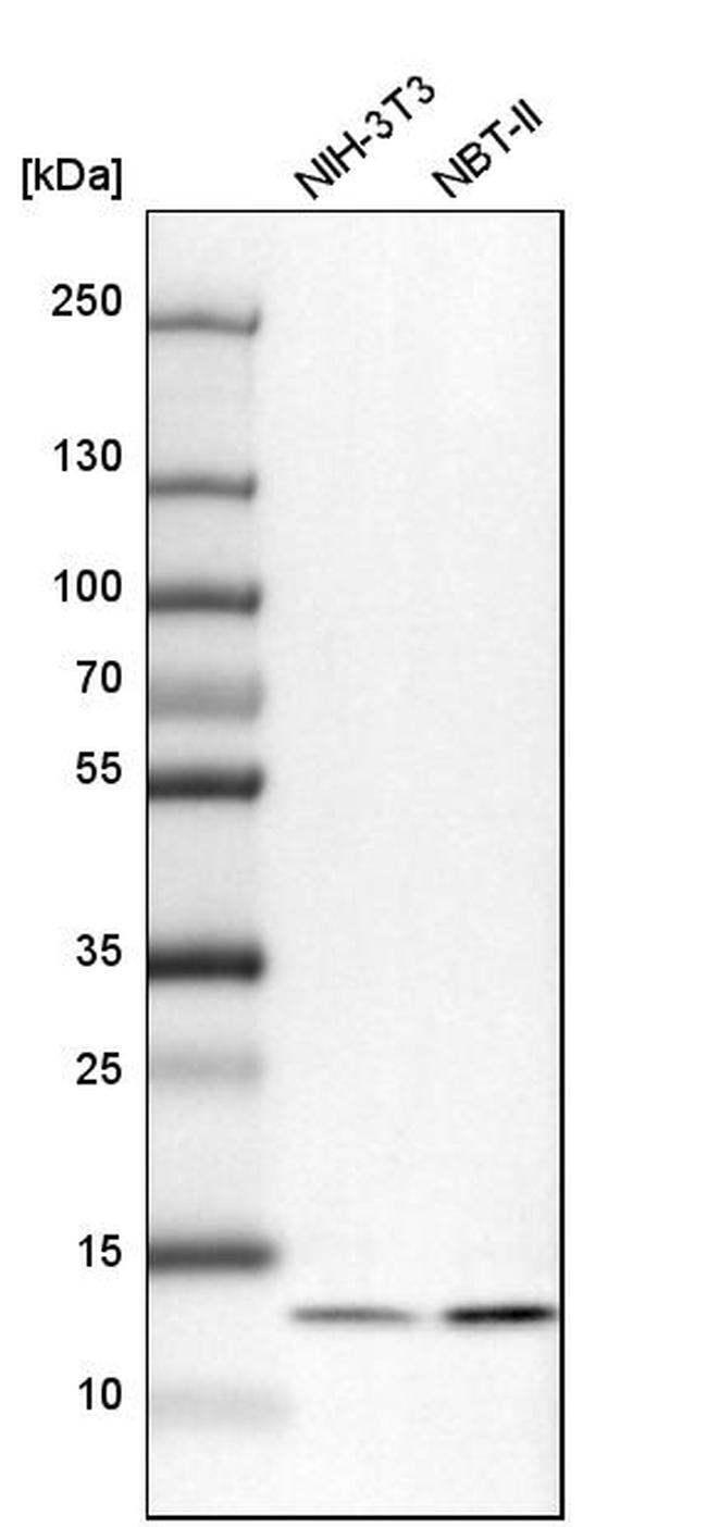 UQCRB Antibody in Western Blot (WB)