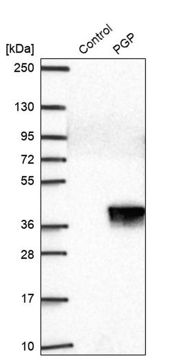 PGP Antibody in Western Blot (WB)