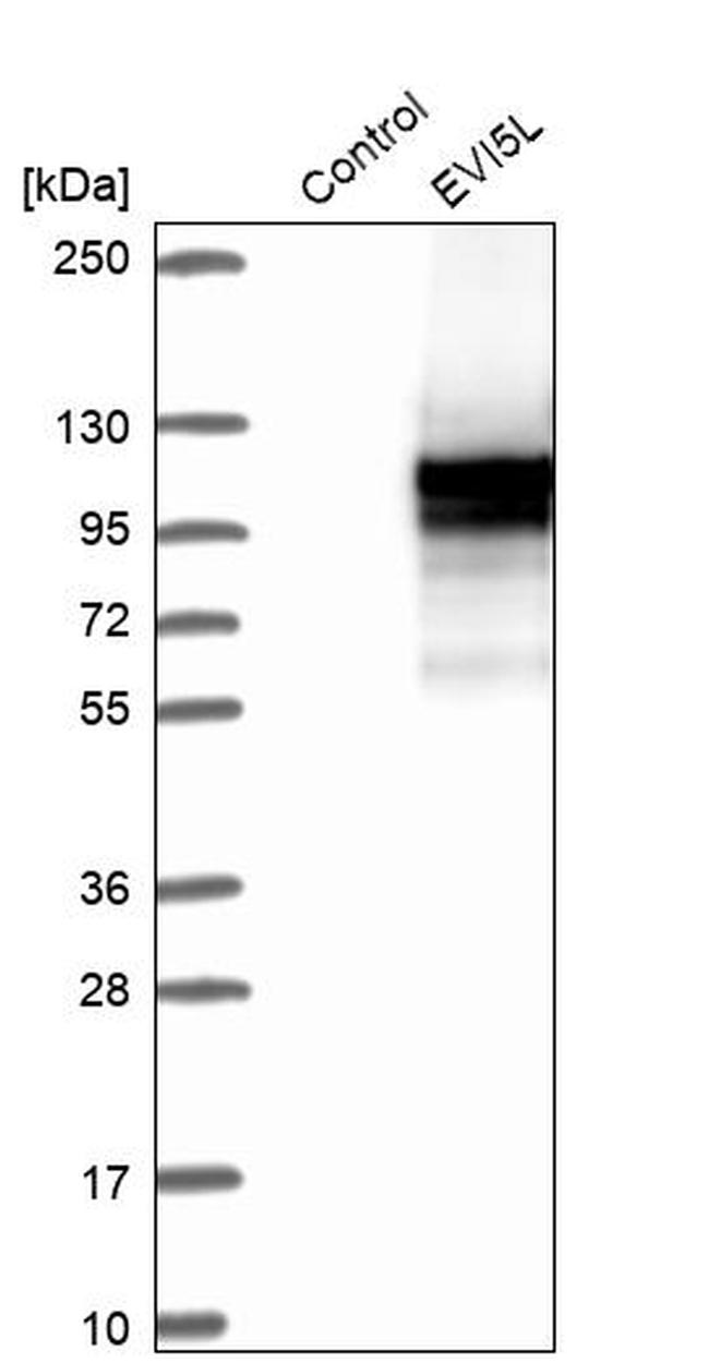 EVI5L Antibody in Western Blot (WB)