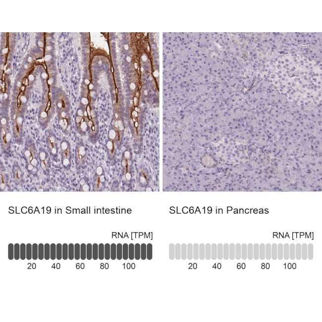 SLC6A19 Antibody in Immunohistochemistry (IHC)