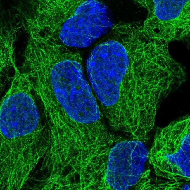 NEK3 Antibody in Immunocytochemistry (ICC/IF)