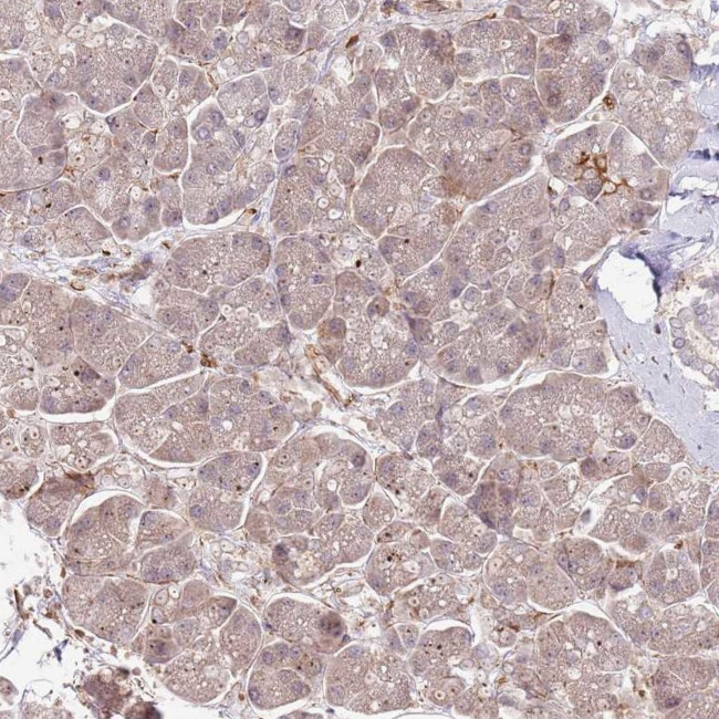 NEK3 Antibody in Immunohistochemistry (IHC)