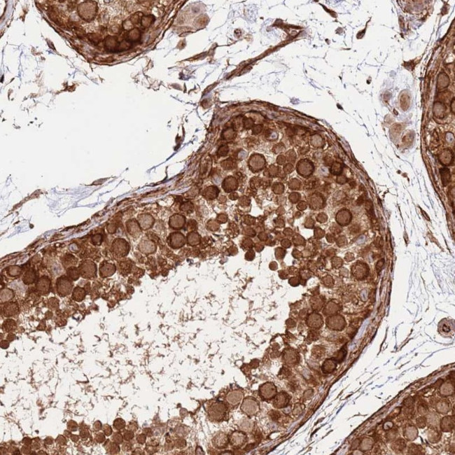 NEK3 Antibody in Immunohistochemistry (IHC)