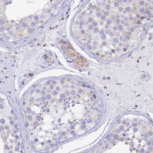 GCDH Antibody in Immunohistochemistry (IHC)