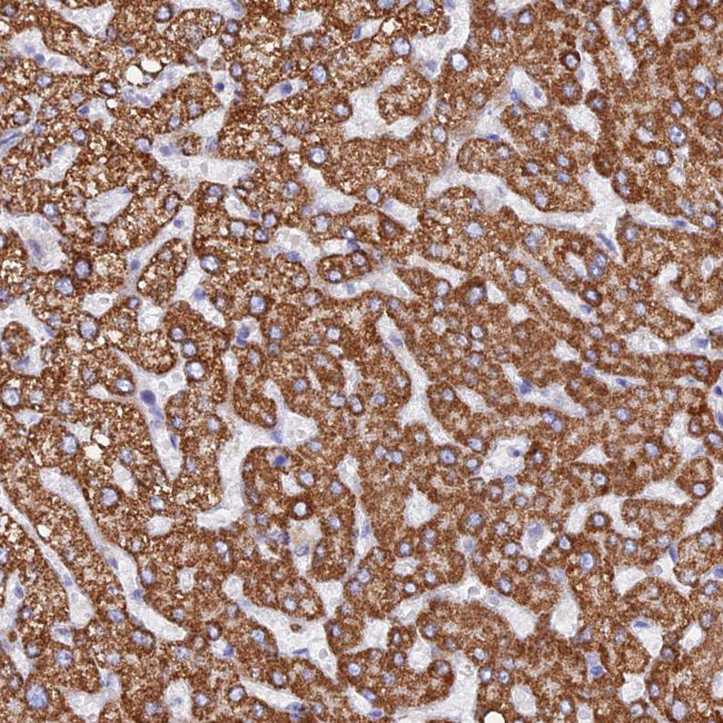 GCDH Antibody in Immunohistochemistry (IHC)