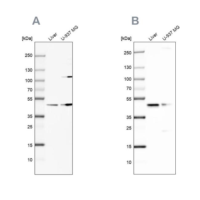 GCDH Antibody in Western Blot (WB)