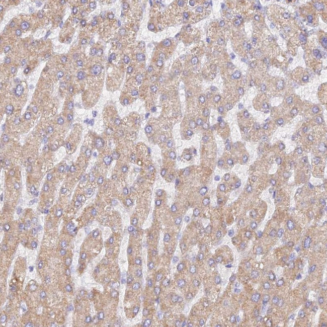 WDR62 Antibody in Immunohistochemistry (IHC)