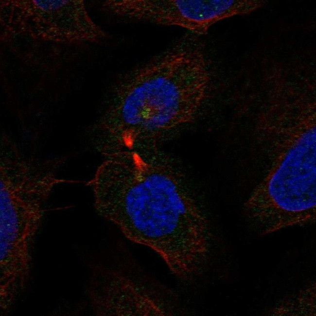 WDR62 Antibody in Immunocytochemistry (ICC/IF)