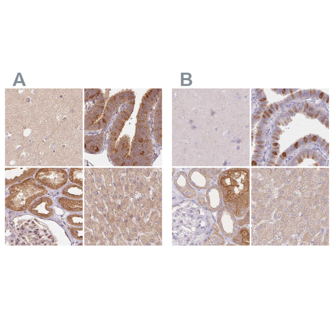 WDR54 Antibody in Immunohistochemistry (IHC)